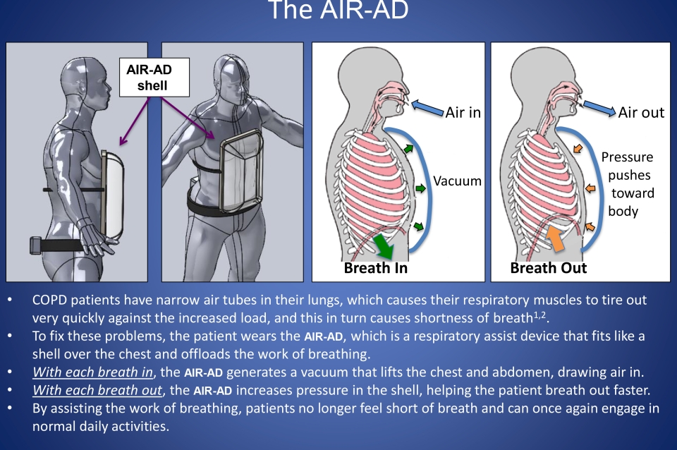 Product breakdown of breathing assistance technology, AIR-AD