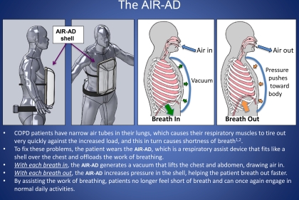 Product breakdown of breathing assistance technology, AIR-AD